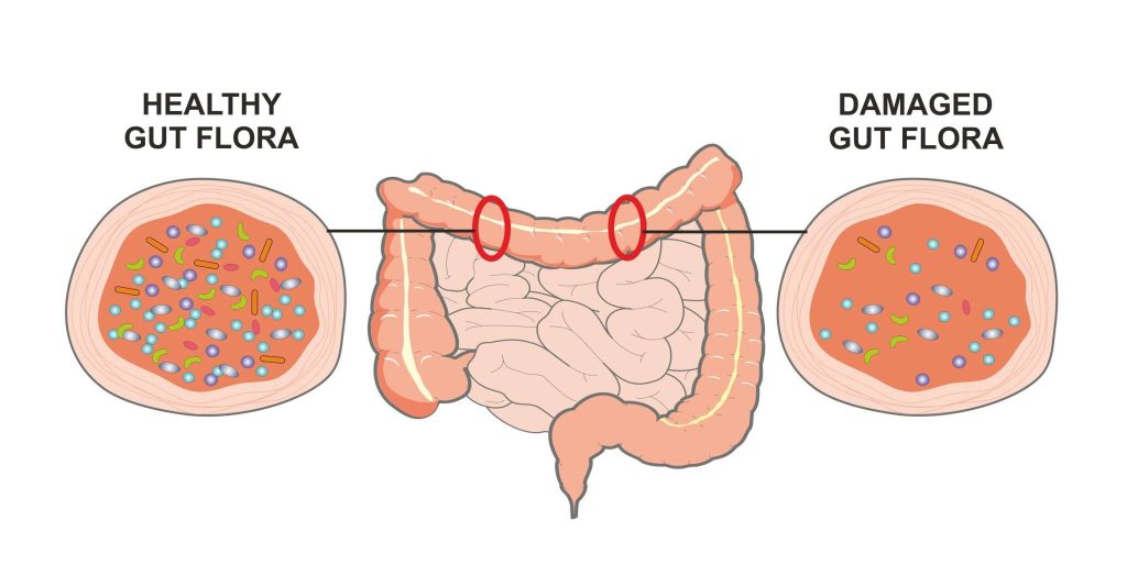 Phân biệt enzyme và men tiêu hóa giúp hiểu rõ vai trò của từng loại trong hỗ trợ tiêu hóa, từ đó lựa chọn giải pháp phù hợp cho cơ thể.