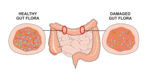 Phân biệt enzyme và men tiêu hóa giúp hiểu rõ vai trò của từng loại trong hỗ trợ tiêu hóa, từ đó lựa chọn giải pháp phù hợp cho cơ thể.