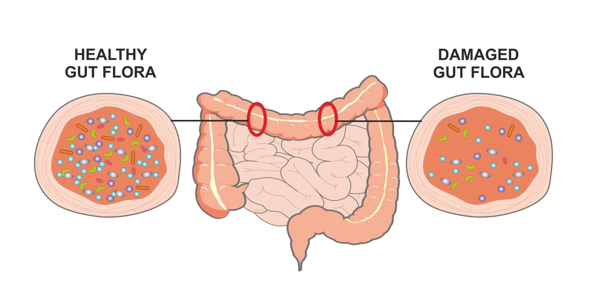 Phân biệt enzyme và men tiêu hóa giúp hiểu rõ vai trò của từng loại trong hỗ trợ tiêu hóa, từ đó lựa chọn giải pháp phù hợp cho cơ thể.
